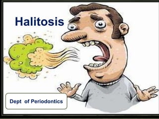 Halitosis
Dept of Periodontics
 