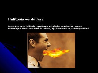 Halitosis verdadera
Se conoce como halitosis verdadera o patológica aquella que no está
causada por el uso ocasional de cebolla, ajo, condimentos, tabaco y alcohol.
 