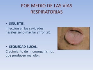 POR MEDIO DE LAS VIAS
RESPIRATORIAS
• SINUSITIS.
Infección en las cavidades
nasales(seno maxilar y frontal).

• SEQUEDAD BUCAL.
Crecimiento de microorganismos
que producen mal olor.

 