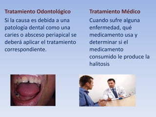 Tratamiento Odontológico
Si la causa es debida a una
patología dental como una
caries o absceso periapical se
deberá aplicar el tratamiento
correspondiente.

Tratamiento Médico
Cuando sufre alguna
enfermedad, qué
medicamento usa y
determinar si el
medicamento
consumido le produce la
halitosis

 
