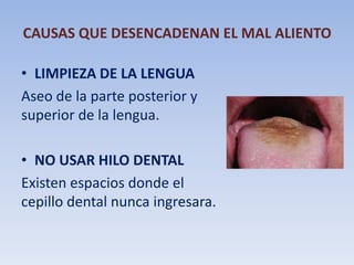 CAUSAS QUE DESENCADENAN EL MAL ALIENTO
• LIMPIEZA DE LA LENGUA
Aseo de la parte posterior y
superior de la lengua.

• NO USAR HILO DENTAL
Existen espacios donde el
cepillo dental nunca ingresara.

 