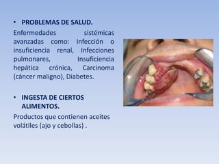 • PROBLEMAS DE SALUD.
Enfermedades
sistémicas
avanzadas como: Infección o
insuficiencia renal, Infecciones
pulmonares,
Insuficiencia
hepática crónica, Carcinoma
(cáncer maligno), Diabetes.
• INGESTA DE CIERTOS
ALIMENTOS.
Productos que contienen aceites
volátiles (ajo y cebollas) .

 