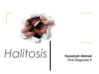 Halitosis Ousamah Ahmad
Oral Diagnosis II
 
