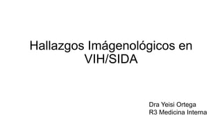 Hallazgos Imágenológicos en
VIH/SIDA
Dra Yeisi Ortega
R3 Medicina Interna
 