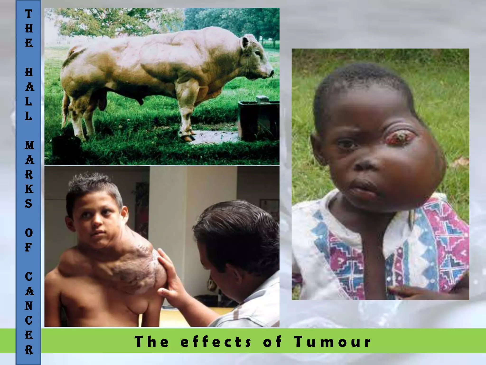 T h e e f f e c t s o f T u m o u r
T
H
E
H
A
L
L
M
A
R
K
S
O
F
C
A
N
C
E
R
 