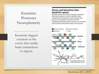 Ketamine
Promotes
Neuroplasticity
Ketamine triggers
reactions in the
cortex that enable
brain connections
to regrow.
Moda-Sava, R.N., (2019)
 