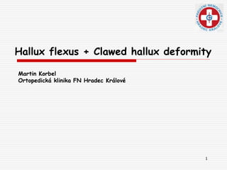 1
Hallux flexus + Clawed hallux deformity
Martin Korbel
Ortopedická klinika FN Hradec Králové
 