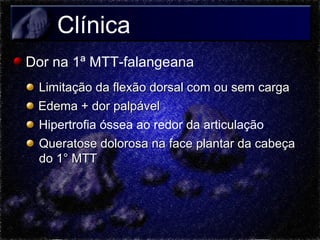 Clínica
Dor na 1ª MTT-falangeana
Limitação da flexão dorsal com ou sem carga
Edema + dor palpável
Hipertrofia óssea ao redor da articulação
Queratose dolorosa na face plantar da cabeça
do 1° MTT

 