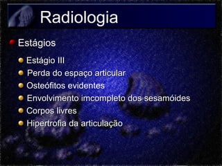 Radiologia
Estágios
Estágio III
Perda do espaço articular
Osteófitos evidentes
Envolvimento imcompleto dos sesamóides
Corpos livres
Hipertrofia da articulação

 