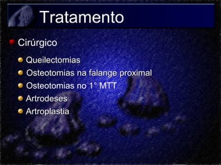 Tratamento
Cirúrgico
Queilectomias
Osteotomias na falange proximal
Osteotomias no 1° MTT
Artrodeses
Artroplastia

 