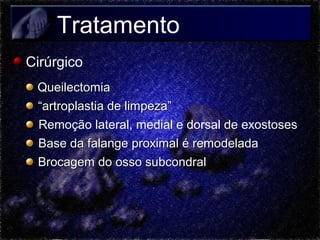 Tratamento
Cirúrgico
Queilectomia
“artroplastia de limpeza”
Remoção lateral, medial e dorsal de exostoses
Base da falange proximal é remodelada
Brocagem do osso subcondral

 