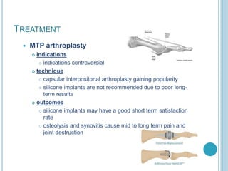 TREATMENT
 MTP arthroplasty
 indications
 indications controversial
 technique
 capsular interpositonal arthroplasty gaining popularity
 silicone implants are not recommended due to poor long-
term results
 outcomes
 silicone implants may have a good short term satisfaction
rate
 osteolysis and synovitis cause mid to long term pain and
joint destruction
 