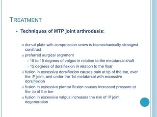 TREATMENT
 Techniques of MTP joint arthrodesis:
 dorsal plate with compression screw is biomechanically strongest
construct
 preferred surgical alignment
 10 to 15 degrees of valgus in relation to the metatarsal shaft
 15 degrees of dorsiflexion in relation to the floor
 fusion in excessive dorsiflexion causes pain at tip of the toe, over
the IP joint, and under the 1st metatarsal with excessive
dorsiflexion
 fusion in excessive plantar flexion causes increased pressure at
the tip of the toe
 fusion in excessive valgus increases the risk of IP joint
degeneration
 