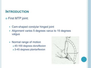 INTRODUCTION
 First MTP joint:
 Cam-shaped condylar hinged joint
 Alignment varies 5 degrees varus to 15 degrees
valgus
 Normal range of motion
 40-100 degrees dorsiflexion
 3-45 degrees plantarflexion
 