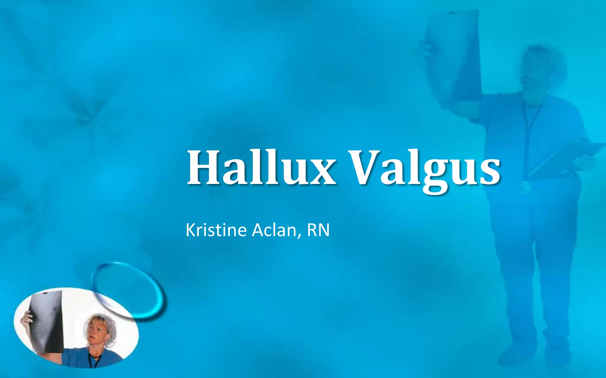 Hallux Valgus
Kristine Aclan, RN