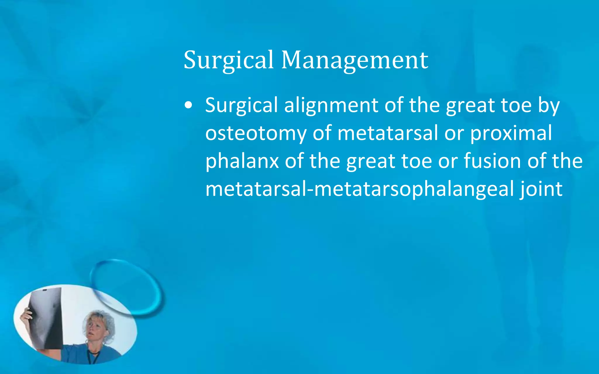 Surgical Management
• Surgical alignment of the great toe by
osteotomy of metatarsal or proximal
phalanx of the great toe or fusion of the
metatarsal-metatarsophalangeal joint