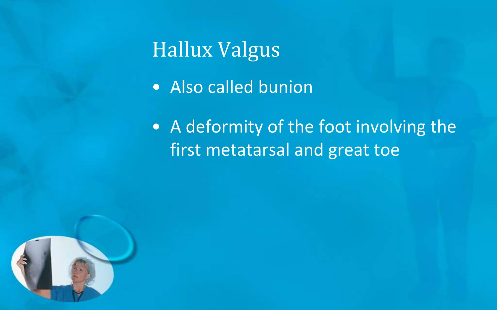 Hallux Valgus
• Also called bunion
• A deformity of the foot involving the
first metatarsal and great toe