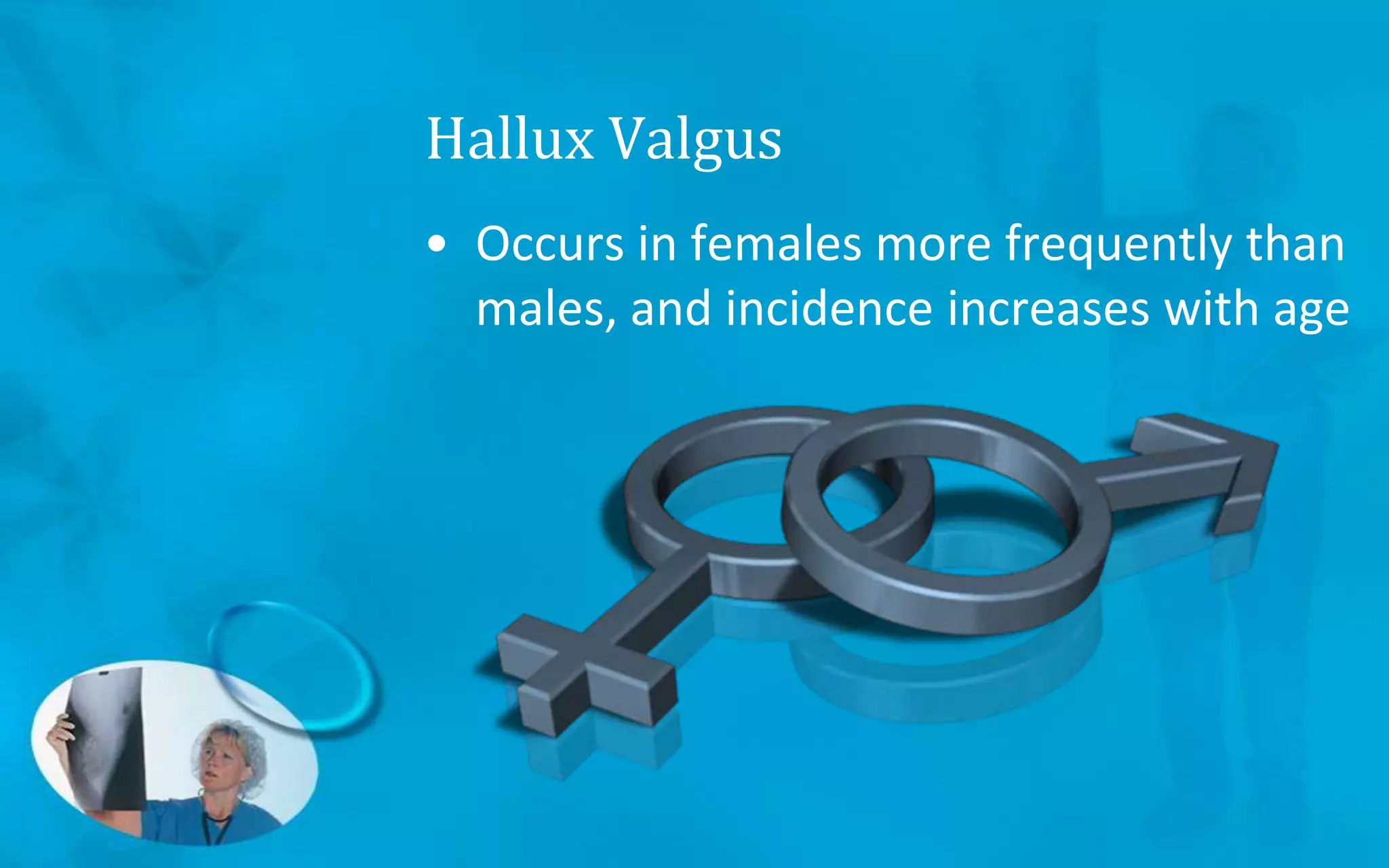 Hallux Valgus
• Occurs in females more frequently than
males, and incidence increases with age
