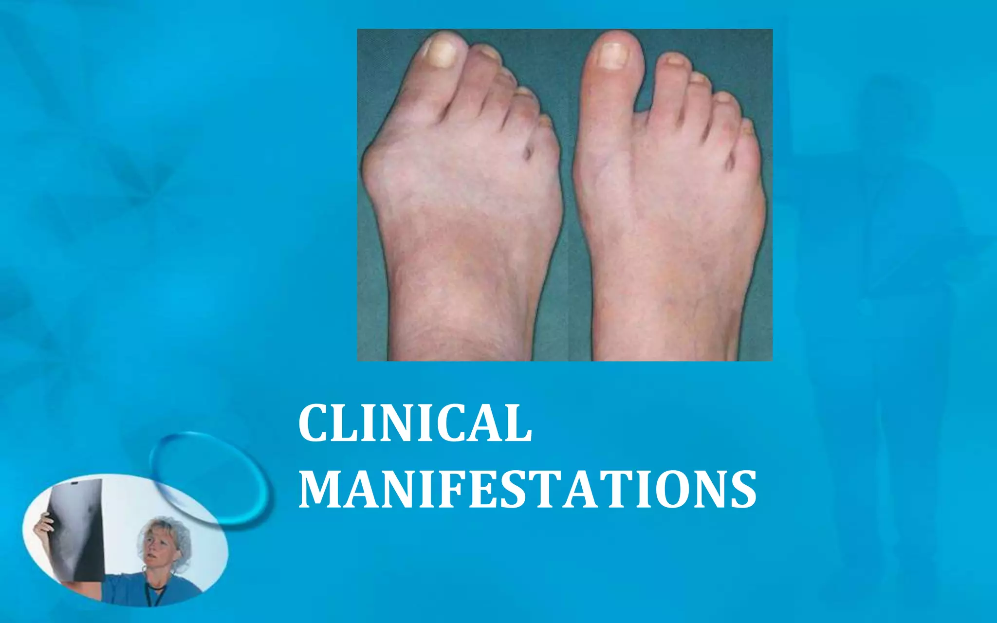 CLINICAL
MANIFESTATIONS