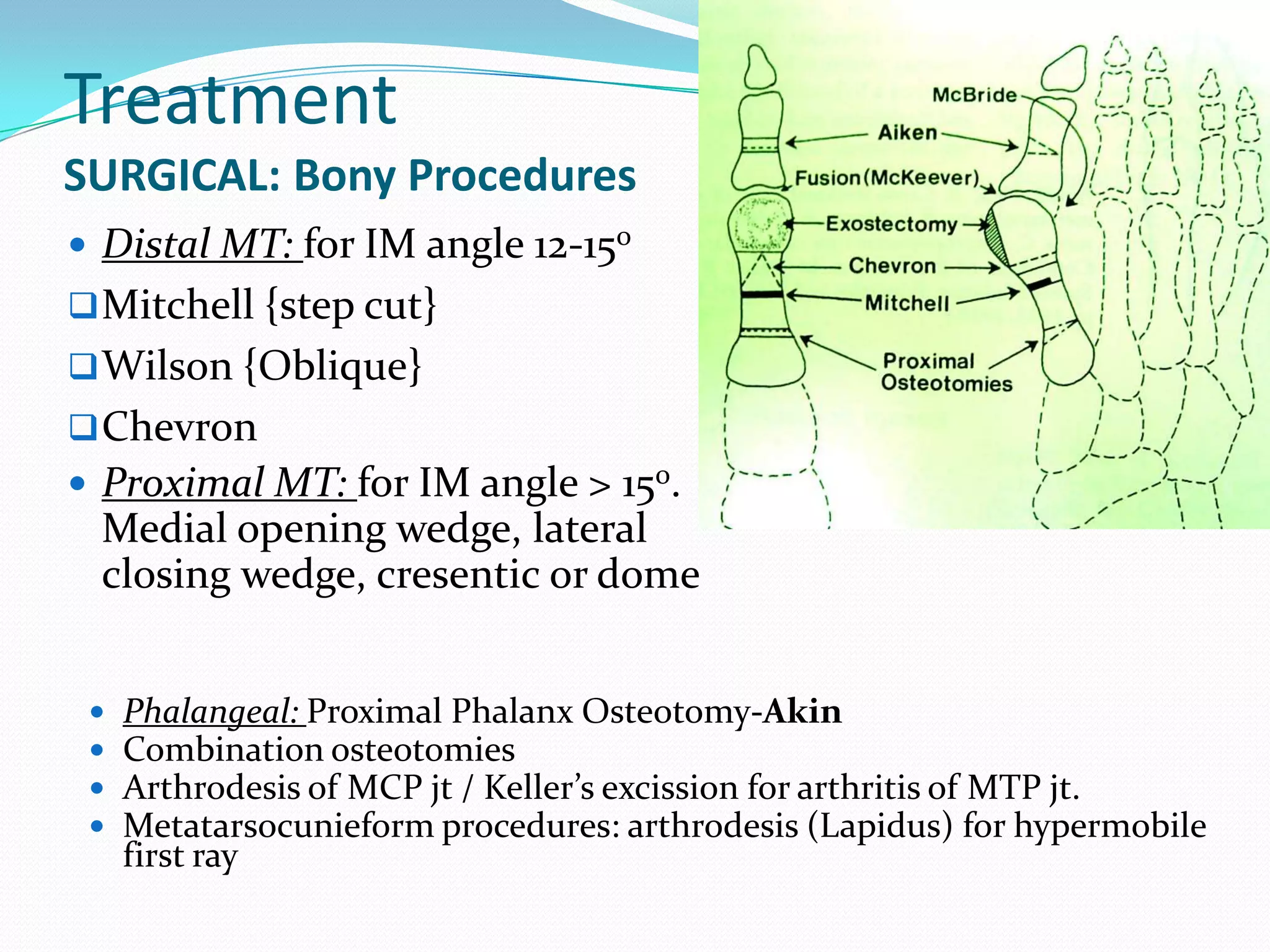 Treatment
SURGICAL: Bony Procedures
 Distal MT: for IM angle 12-150
 Mitchell {step cut}
 Wilson {Oblique}
 Chevron
 Proximal MT: for IM angle > 150.
 Medial opening wedge, lateral
 closing wedge, cresentic or dome


    Phalangeal: Proximal Phalanx Osteotomy-Akin
    Combination osteotomies
    Arthrodesis of MCP jt / Keller’s excission for arthritis of MTP jt.
    Metatarsocunieform procedures: arthrodesis (Lapidus) for hypermobile
     first ray
 