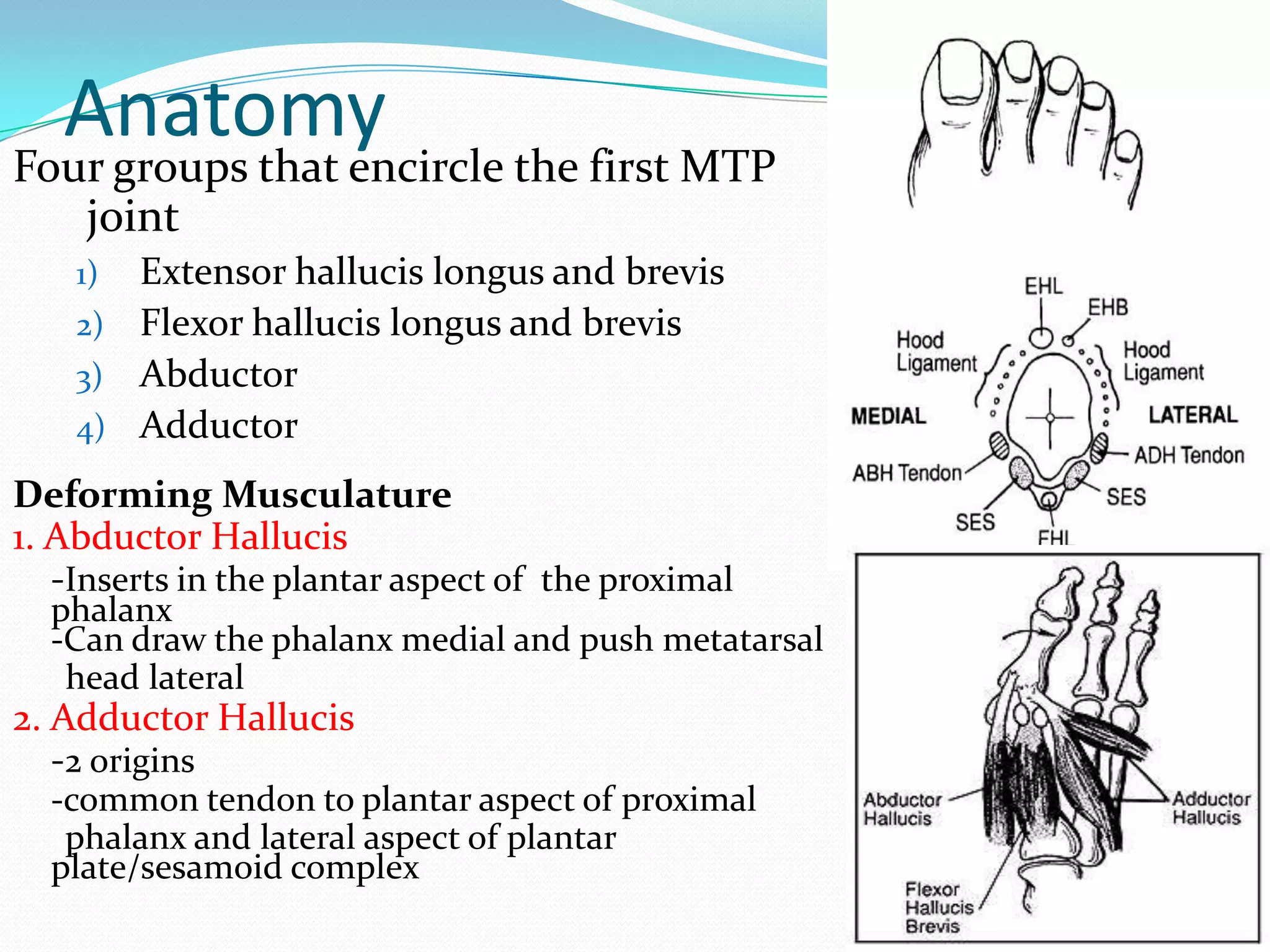 Anatomy
Four groups that encircle the first MTP
   joint
    1) Extensor hallucis longus and brevis
    2) Flexor hallucis longus and brevis
    3) Abductor
    4) Adductor

Deforming Musculature
1. Abductor Hallucis
   -Inserts in the plantar aspect of the proximal
  phalanx
  -Can draw the phalanx medial and push metatarsal
   head lateral
2. Adductor Hallucis
   -2 origins
  -common tendon to plantar aspect of proximal
   phalanx and lateral aspect of plantar
  plate/sesamoid complex
 