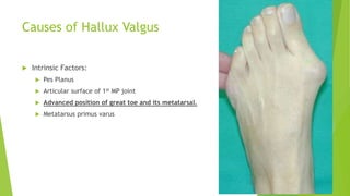 Causes of Hallux Valgus
 Intrinsic Factors:
 Pes Planus
 Articular surface of 1st MP joint
 Advanced position of great toe and its metatarsal.
 Metatarsus primus varus
 