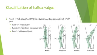 Classification of hallux valgus
 Pigott (1960) classified HV into 3 types based on congruity of 1st MP
joint
 Type 1: Congrous joint
 Type 2: Deviated non congruous joint
 Type 3: Subluxated joint
 