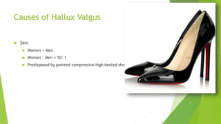 Causes of Hallux Valgus
 Sex:
 Women > Men
 Women : Men = 50: 1
 Predisposed by pointed compressive high heeled shoes
 