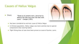 Causes of Hallux Valgus
 Shoes:
 Has been considered as extrinsic cause of Hallux Valgus
 In Chinese population, Hallux valgus was more common due to special
compressive shoe wearing habits.
 Tight fitting show at toes have been proven as cause of bunion, corns.
“Shoes as at present worn, serve but to
deform the toes and cover the feet with
corns” – Camper (1781)
 
