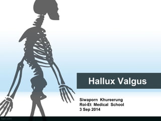 Hallux Valgus
Siwaporn Khureerung
Roi-Et Medical School
3 Sep 2014
 
