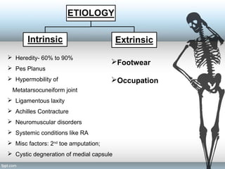 Footwear
Occupation
 Heredity- 60% to 90%
 Pes Planus
 Hypermobility of
Metatarsocuneiform joint
 Ligamentous laxity
 Achilles Contracture
 Neuromuscular disorders
 Systemic conditions like RA
 Misc factors: 2nd
toe amputation;
 Cystic degneration of medial capsule
 
