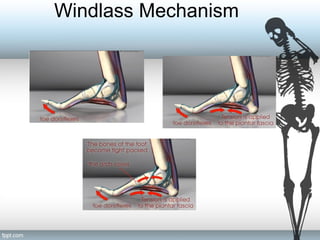 Windlass Mechanism
 