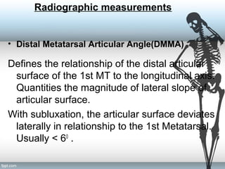 Radiographic measurements
• Distal Metatarsal Articular Angle(DMMA)
Defines the relationship of the distal articular
surface of the 1st MT to the longitudinal axis.
Quantities the magnitude of lateral slope of
articular surface.
With subluxation, the articular surface deviates
laterally in relationship to the 1st Metatarsal.
Usually < 60
.
 