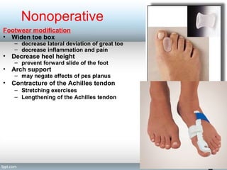 Nonoperative
Footwear modification
• Widen toe box
– decrease lateral deviation of great toe
– decrease inflammation and pain
• Decrease heel height
– prevent forward slide of the foot
• Arch support
– may negate effects of pes planus
• Contracture of the Achilles tendon
– Stretching exercises
– Lengthening of the Achilles tendon
 