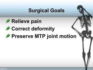 Relieve pain
Correct deformity
Preserve MTP joint motion
Surgical GoalsSurgical Goals
 