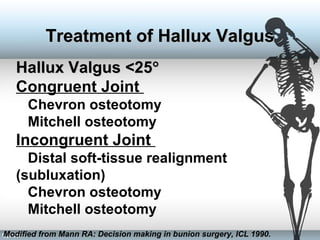 Hallux Valgus <25Hallux Valgus <25°°
Congruent Joint
Chevron osteotomy
Mitchell osteotomy
Incongruent Joint
Distal soft-tissue realignment
(subluxation)
Chevron osteotomy
Mitchell osteotomy
Modified from Mann RA: Decision making in bunion surgery, ICL 1990.
Treatment of Hallux ValgusTreatment of Hallux Valgus
 