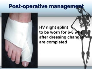 Post-operative managementPost-operative management
HV night splint
to be worn for 6-8 wks
after dressing changes
are completed
 