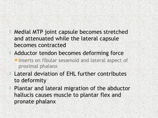  Medial MTP joint capsule becomes stretched
and attenuated while the lateral capsule
becomes contracted
 Adductor tendon becomes deforming force
 inserts on fibular sesamoid and lateral aspect of
proximal phalanx
 Lateral deviation of EHL further contributes
to deformity
 Plantar and lateral migration of the abductor
hallucis causes muscle to plantar flex and
pronate phalanx
 