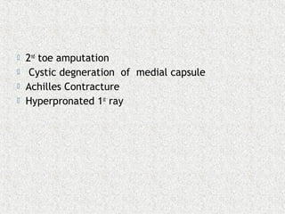  2nd
toe amputation
 Cystic degneration of medial capsule
 Achilles Contracture
 Hyperpronated 1st
ray
 