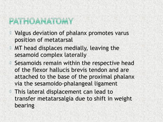  Valgus deviation of phalanx promotes varus
position of metatarsal
 MT head displaces medially, leaving the
sesamoid complex laterally
 Sesamoids remain within the respective head
of the flexor hallucis brevis tendon and are
attached to the base of the proximal phalanx
via the sesamoido-phalangeal ligament
 This lateral displacement can lead to
transfer metatarsalgia due to shift in weight
bearing
 