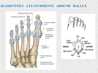 LIGAMENTOUS ATTATCHMENTS AROUND HALLUX
 