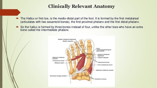 Hallux valgus Deformity