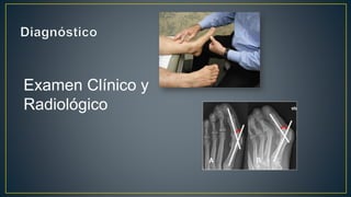 Examen Clínico y
Radiológico
 