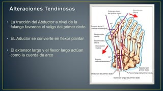• La tracción del Abductor a nivel de la
falange favorece el valgo del primer dedo
• EL Aductor se convierte en flexor plantar
• El extensor largo y el flexor largo actúan
como la cuerda de arco
 