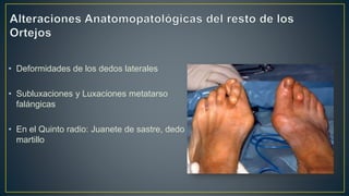 • Deformidades de los dedos laterales
• Subluxaciones y Luxaciones metatarso
falángicas
• En el Quinto radio: Juanete de sastre, dedo en
martillo
 