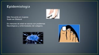 Más frecuente en mujeres
Suele ser Bilateral
En menores de edad se asocia con problemas
Neurológicos y enfermedades del colágeno.
 