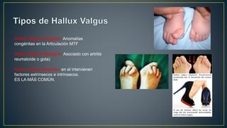 Hallux Valgus Congénito: Anomalías
congénitas en la Articulación MTF
Hallux Valgus Patológico: Asociado con artritis
reumatoide o gota)
Hallux Valgus Adquirido: en el intervienen
factores extrínsecos e intrínsecos.
ES LA MÁS COMÚN.
 