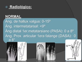 Hallux Valgus PPTX hallux-valgus-pptx