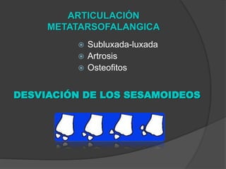 ARTICULACIÓN
METATARSOFALANGICA
 Subluxada-luxada
 Artrosis
 Osteofitos
DESVIACIÓN DE LOS SESAMOIDEOS
 