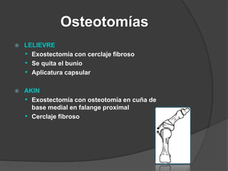 Kramer
Osteotomia subcapital.
Cuña con base medial,
sin abrir la capsula.
1.- 1er MTT
2.- Capsula articular
Bauer. Pie y t...